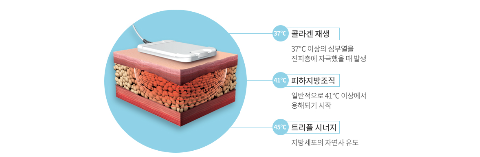 트리플바디 원리 천안피부과 닥터에버스